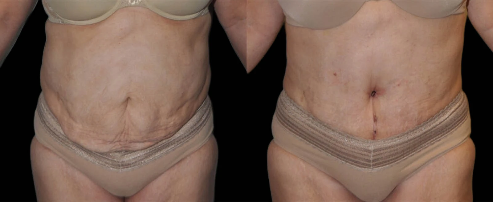 0000_ANTERIOR-VIEW-BA-3.jpg-3