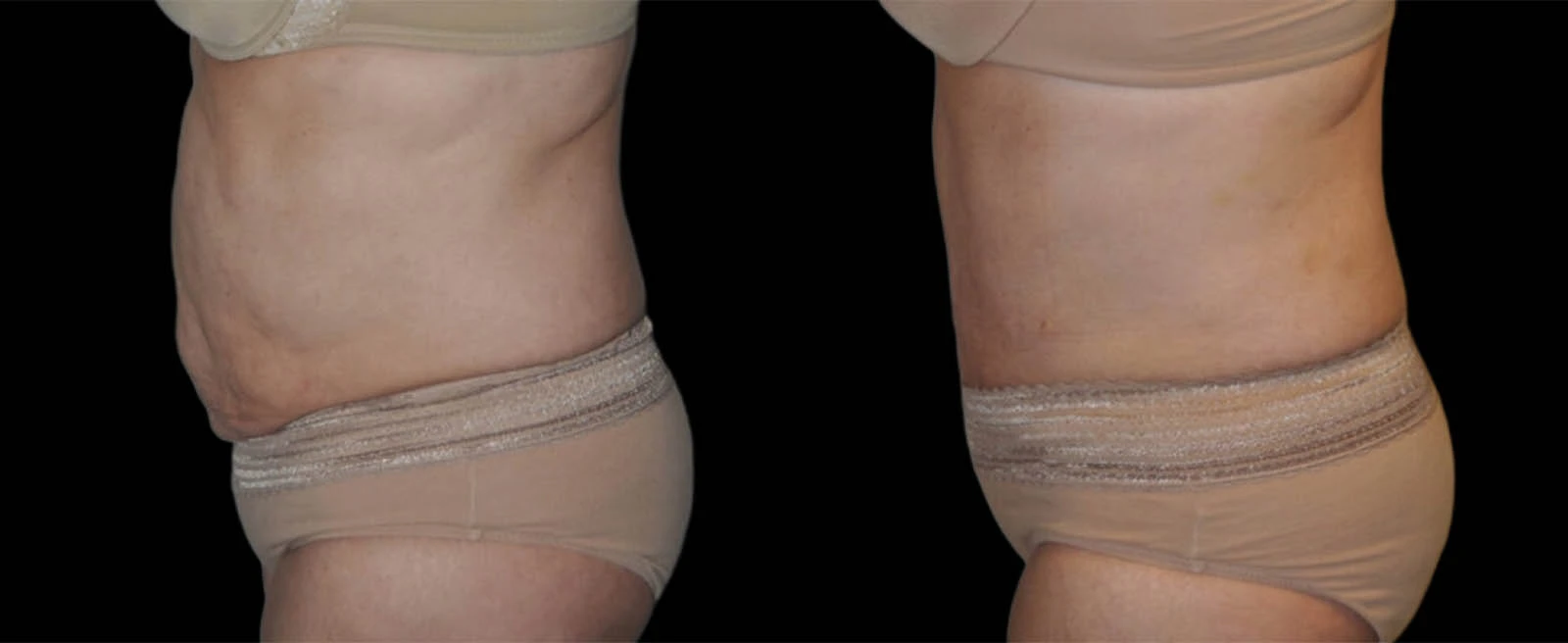 0001_LEFT-LATERAL-VIEW-BA-3.jpg-3